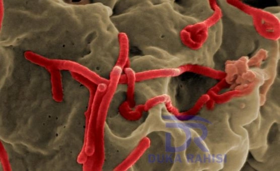 EBOLA DISEASE SYMPTOMS, TRANSMISSION, PREVENTION AND TREATMENT